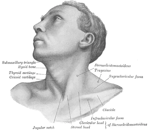 도해: 목빗근 이상으로 인한 사경(torticollis)