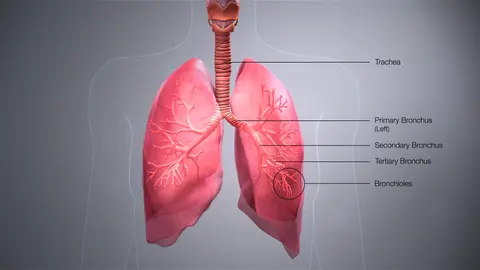 3D 도해: 기관지의 여러 분지 단계