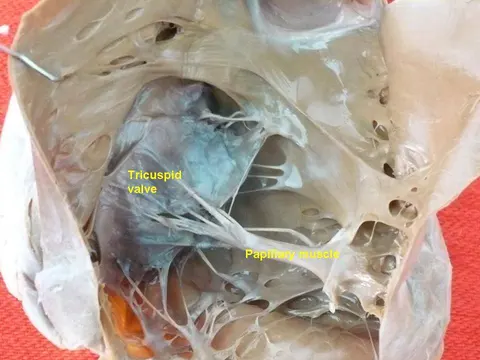 해부 사진: Atrioventricular valve