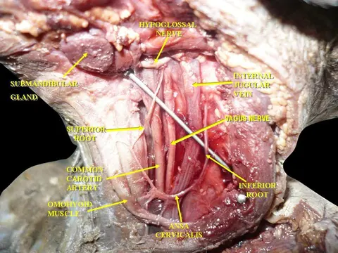 해부 사진: Ansa cervicalis
