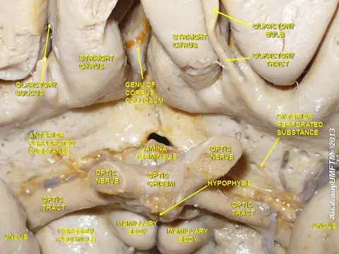 해부 사진: Anterior perforated substance