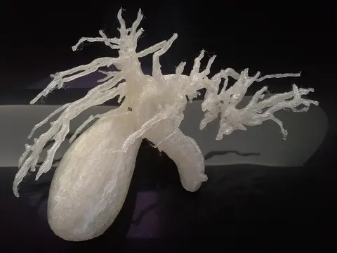 사진: 3D 프린트한 쓸개길 계통 — 수종 쓸개, 확장된 간관