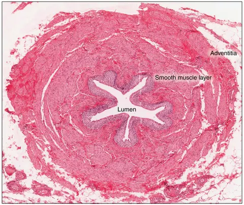 현미경 사진: 요관 가로단면, 상피층
