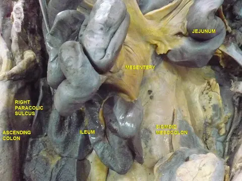 해부 사진: 작은창자와 장간막